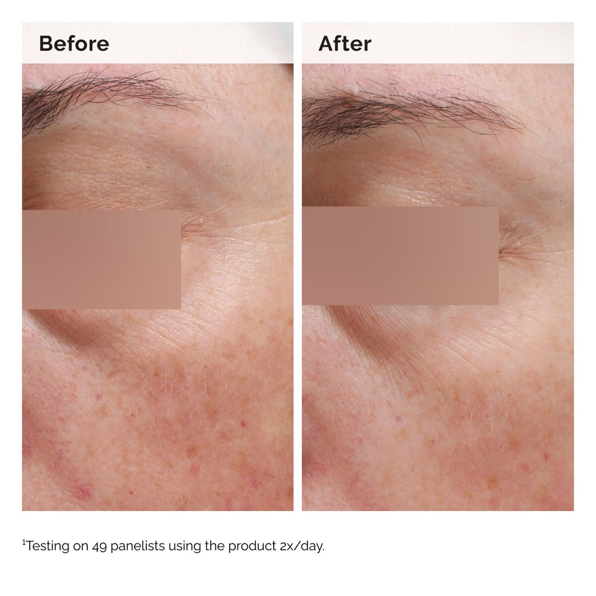 niacinamide-5-face-and-body-emulsion-e6 2024-08-23-ORD-Nia-5pct-Face-Body-B-A-Elasticity-Global-02-1x1.jpg