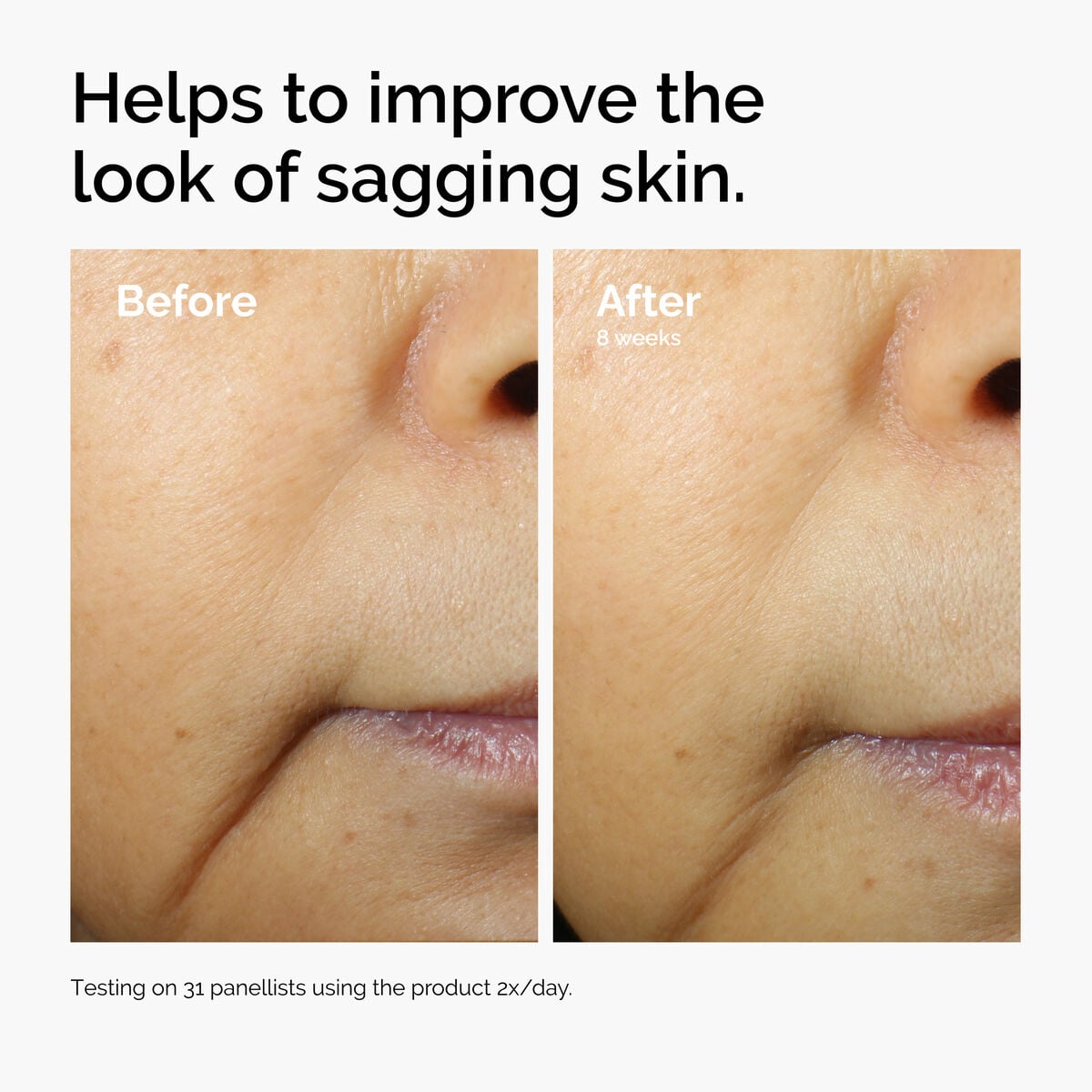 caffeine-3-escin-1-face-serum-r5 ord-caffeine-3pct-escin-1pct-face-serum-before-after-sagging.jpg
