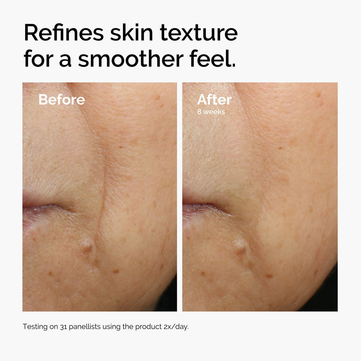 caffeine-3-escin-1-face-serum-r5 ord-caffeine-3pct-escin-1pct-face-serum-before-after-texture.jpg