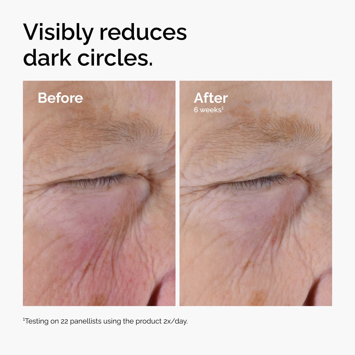 caffeine-solution-5-egcg-eye-serum-d7 ord-caffeine-solution-egcg-dark-circles-before-after.jpg