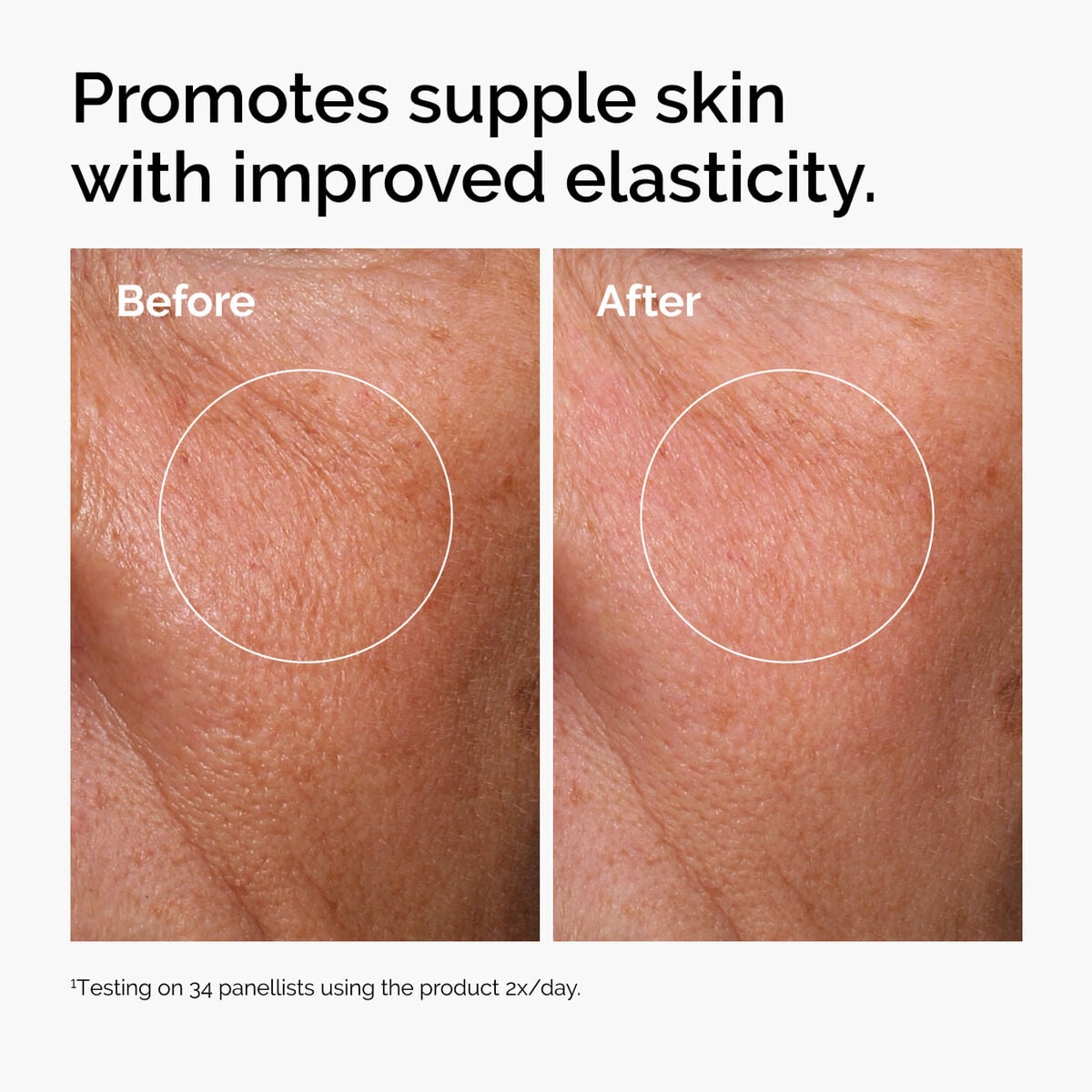 hyaluronic-acid-2-b5-with-ceramides-m7 ord-hyaluronic-acid-2pct-b5-hydrating-serum-before-after-elasticity.jpg