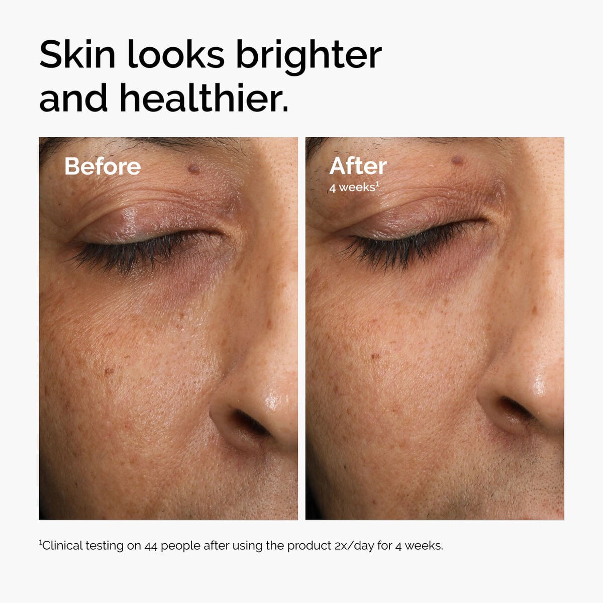 multi-antioxidant-radiance-serum-r3 ord-mars-before-after-healthy.jpg