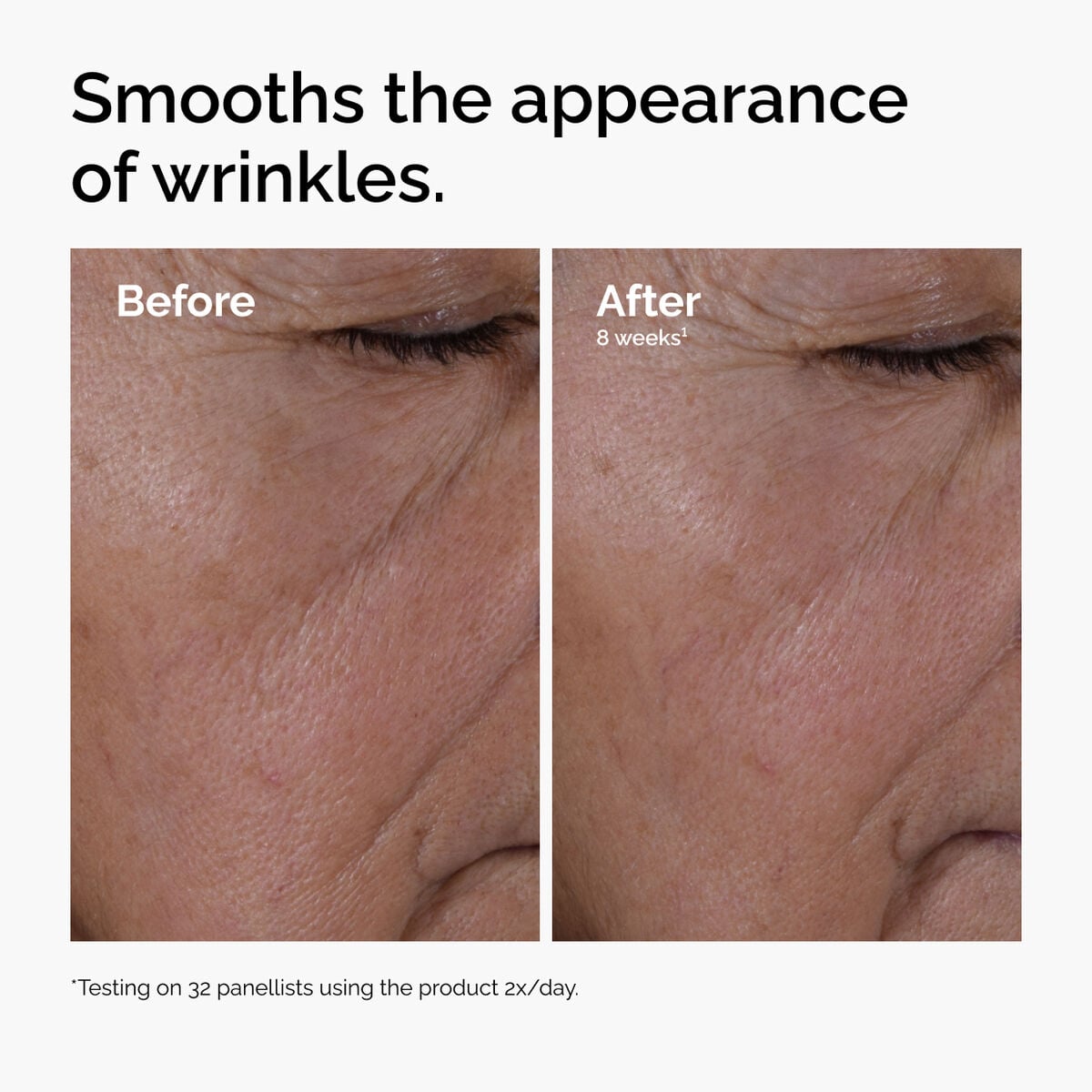 multi-peptide-ha-serum-b6 ord-multi-peptide-ha-serum-wrinkles-before-after.jpg