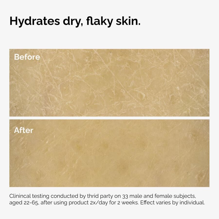 the-body-care-collection-y5 ord-natural-moisturizing-factors-inulin-body-before-after-graphic-02.jpg