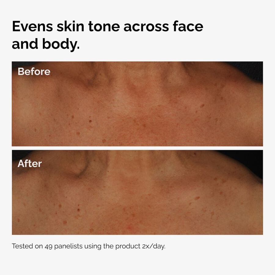 the-body-care-collection-y5 ord-niacinamide-face-body-serum-before-after-even-tone-graphic.jpg