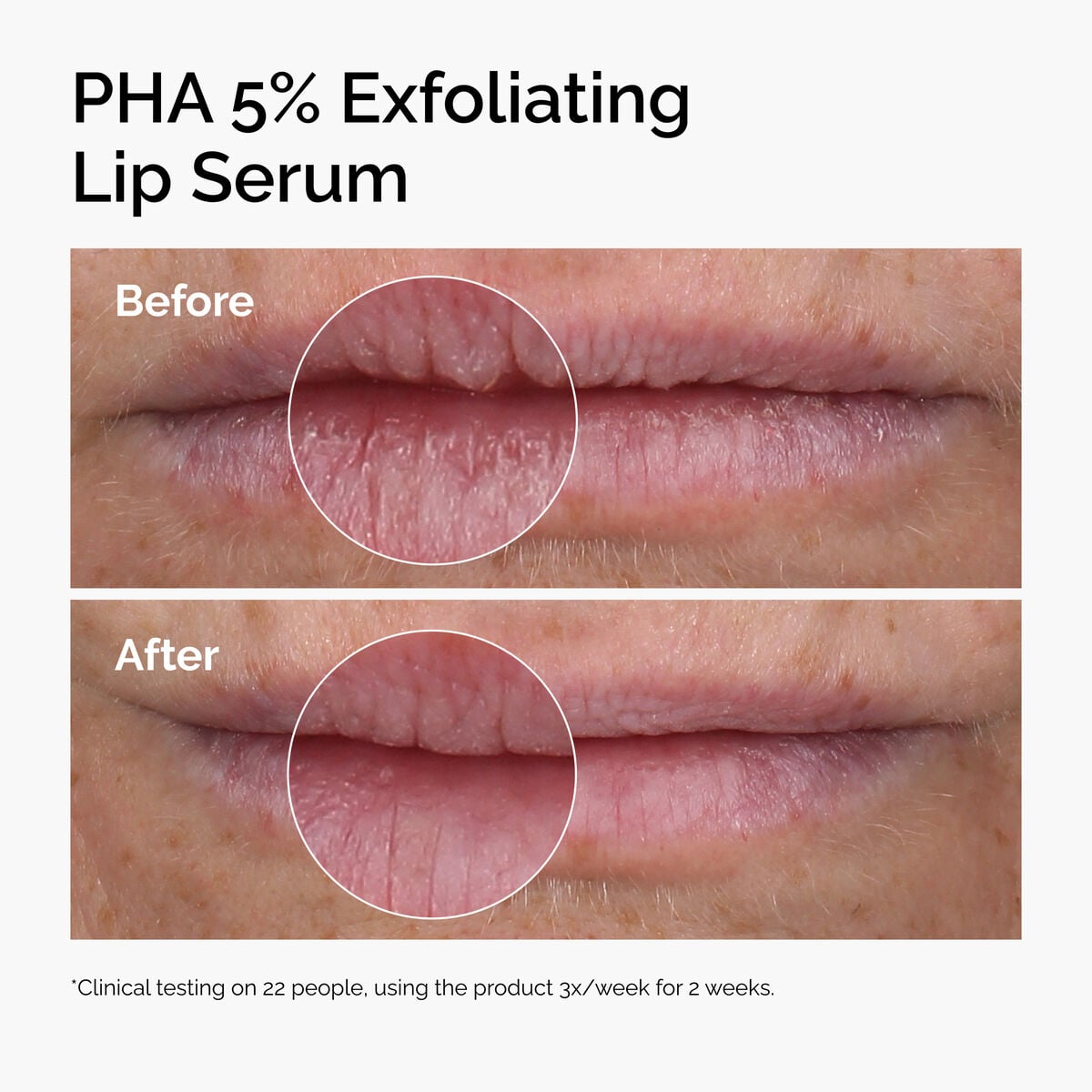 pha-5-exfoliating-lip-serum-c1 ord-pha-5pct-lip-exfoliating-serum-before-after.jpg