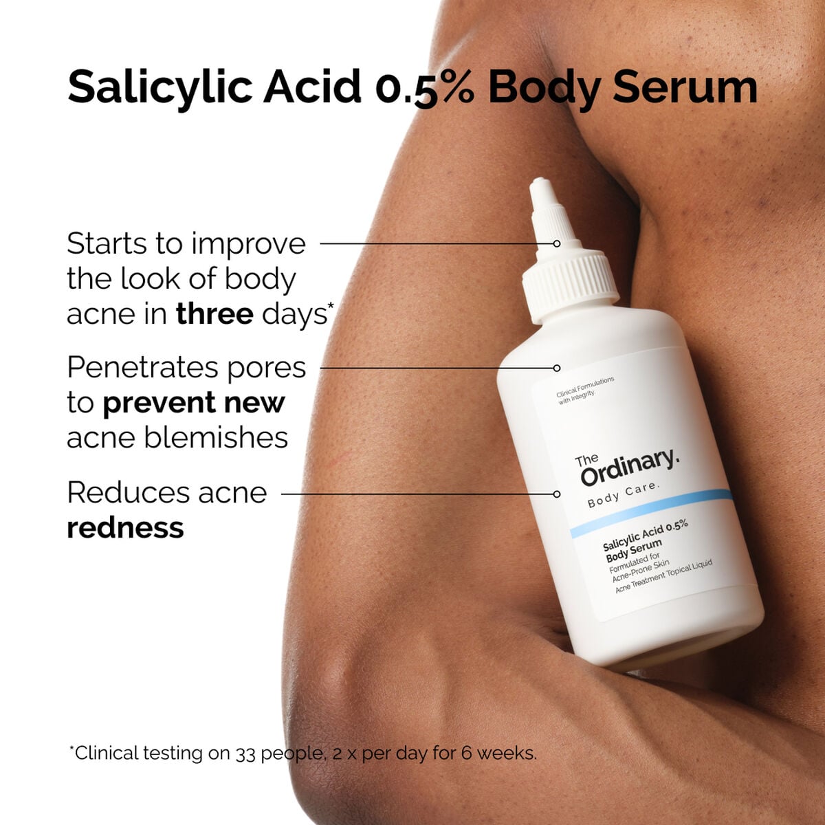 salicylic-acid-0-5-body-serum-v5 ord-salicylic-05-body-serum-otc-benefits-infographic.jpg